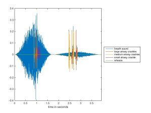 呼吸聲 — 追蹤煙霧